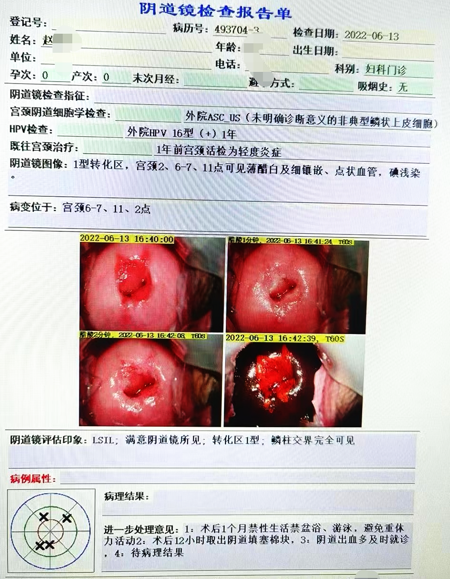 红卡治疗病例解析图文第20230712期